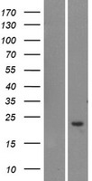TOMM20L Protein - Western validation with an anti-DDK antibody * L: Control HEK293 lysate R: Over-expression lysate