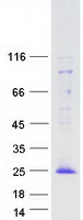 TOMM20L Protein - Purified recombinant protein TOMM20L was analyzed by SDS-PAGE gel and Coomassie Blue Staining