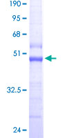 TOMM22 / TOM22 Protein - 12.5% SDS-PAGE of human TOMM22 stained with Coomassie Blue