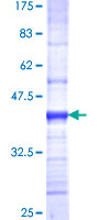 TOMM22 / TOM22 Protein - 12.5% SDS-PAGE Stained with Coomassie Blue.