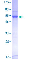 TOMM34 Protein - 12.5% SDS-PAGE of human TOMM34 stained with Coomassie Blue