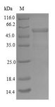 TOMM34 Protein - (Tris-Glycine gel) Discontinuous SDS-PAGE (reduced) with 5% enrichment gel and 15% separation gel.