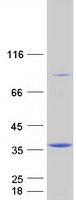 TOMM34 Protein - Purified recombinant protein TOMM34 was analyzed by SDS-PAGE gel and Coomassie Blue Staining
