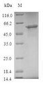 TOMM40 / TOM40 Protein - (Tris-Glycine gel) Discontinuous SDS-PAGE (reduced) with 5% enrichment gel and 15% separation gel.