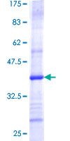 TOMM40 / TOM40 Protein - 12.5% SDS-PAGE Stained with Coomassie Blue.