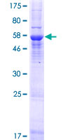 TOMM40L Protein - 12.5% SDS-PAGE of human TOMM40L stained with Coomassie Blue