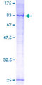TOMM70A Protein - 12.5% SDS-PAGE of human TOMM70A stained with Coomassie Blue