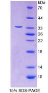 TOMM70A Protein - Recombinant  Translocase Of Outer Mitochondrial Membrane 70A By SDS-PAGE