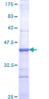 TONSL Protein - 12.5% SDS-PAGE Stained with Coomassie Blue.