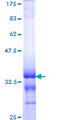 TOP1 / Topoisomerase I Protein - 12.5% SDS-PAGE Stained with Coomassie Blue.