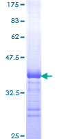 TOP2A / Topoisomerase II Alpha Protein - 12.5% SDS-PAGE Stained with Coomassie Blue.