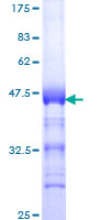 TOP2B / Topoisomerase II Beta Protein - 12.5% SDS-PAGE Stained with Coomassie Blue.