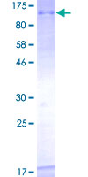 TOP3B Protein - 12.5% SDS-PAGE of human TOP3B stained with Coomassie Blue