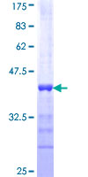 TOPBP1 Protein - 12.5% SDS-PAGE Stained with Coomassie Blue.