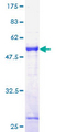TOR1A / Torsin A Protein - 12.5% SDS-PAGE of human TOR1A stained with Coomassie Blue