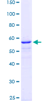 TOR1A / Torsin A Protein - 12.5% SDS-PAGE Stained with Coomassie Blue.