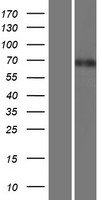 TOR1AIP1 / LAP1 Protein - Western validation with an anti-DDK antibody * L: Control HEK293 lysate R: Over-expression lysate