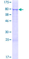 TOR1AIP1 / LAP1 Protein - 12.5% SDS-PAGE of human TOR1AIP1 stained with Coomassie Blue