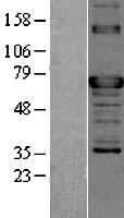 TOR1AIP2 Protein - Western validation with an anti-DDK antibody * L: Control HEK293 lysate R: Over-expression lysate