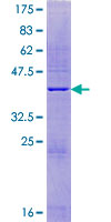 TOR1AIP2 Protein - 12.5% SDS-PAGE of human IFRG15 stained with Coomassie Blue