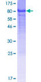 TOR1AIP2 Protein - 12.5% SDS-PAGE of human TOR1AIP2 stained with Coomassie Blue