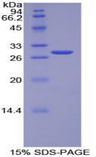 TOR1AIP2 Protein - Recombinant Torsin A Interacting Protein 2 By SDS-PAGE