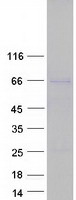 TOR1AIP2 Protein - Purified recombinant protein TOR1AIP2 was analyzed by SDS-PAGE gel and Coomassie Blue Staining
