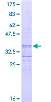TOR1B / Torsin B Protein - 12.5% SDS-PAGE Stained with Coomassie Blue.
