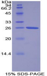 TOR2A Protein - Recombinant Torsin 2A By SDS-PAGE