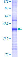 TOR3A Protein - 12.5% SDS-PAGE Stained with Coomassie Blue.