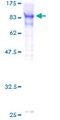 TOX Protein - 12.5% SDS-PAGE of human TOX stained with Coomassie Blue
