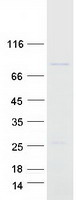 TOX Protein - Purified recombinant protein TOX was analyzed by SDS-PAGE gel and Coomassie Blue Staining