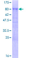 TOX2 Protein - 12.5% SDS-PAGE of human C20orf100 stained with Coomassie Blue