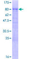 TOX2 Protein - 12.5% SDS-PAGE of human C20orf100 stained with Coomassie Blue