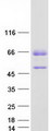 TOX2 Protein - Purified recombinant protein TOX2 was analyzed by SDS-PAGE gel and Coomassie Blue Staining