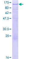 TOX4 / C14orf92 Protein - 12.5% SDS-PAGE of human TOX4 stained with Coomassie Blue