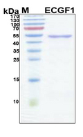 TP / Thymidine Phosphorylase Protein - SDS-PAGE under reducing conditions and visualized by Coomassie blue staining