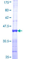 TP1 / TEP1 Protein - 12.5% SDS-PAGE Stained with Coomassie Blue.