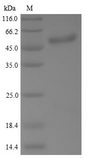 TP53 / p53 Protein - (Tris-Glycine gel) Discontinuous SDS-PAGE (reduced) with 5% enrichment gel and 15% separation gel.