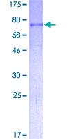 TP53 / p53 Protein - 12.5% SDS-PAGE of human TP53 stained with Coomassie Blue