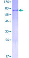 TP53 / p53 Protein - 12.5% SDS-PAGE of human TP53 stained with Coomassie Blue