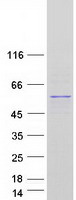 TP53 / p53 Protein - Purified recombinant protein TP53 was analyzed by SDS-PAGE gel and Coomassie Blue Staining