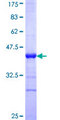 TP53AIP1 / p53 AIP1 Protein