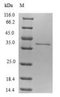 TP53AIP1 / p53 AIP1 Protein - (Tris-Glycine gel) Discontinuous SDS-PAGE (reduced) with 5% enrichment gel and 15% separation gel.
