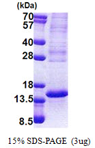 TP53AIP1 / p53 AIP1 Protein
