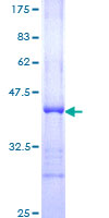 TP53BP1 / 53BP1 Protein - 12.5% SDS-PAGE Stained with Coomassie Blue.