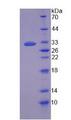 TP53BP1 / 53BP1 Protein - Recombinant  Tumor Protein p53 Binding Protein 1 By SDS-PAGE