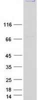TP53BP1 / 53BP1 Protein - Purified recombinant protein TP53BP1 was analyzed by SDS-PAGE gel and Coomassie Blue Staining