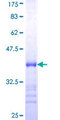 TP53BP2 / ASPP2 Protein - 12.5% SDS-PAGE Stained with Coomassie Blue.