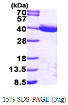 TP53I3 / PIG3 Protein